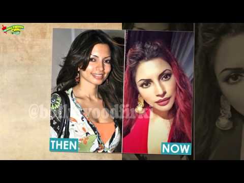 download lagu mp3 mp4 Shama Sikander Surgery, download lagu Shama Sikander Surgery gratis, unduh video klip Shama Sikander Surgery