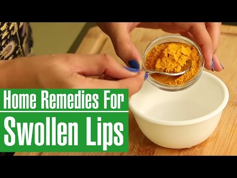 腫れた唇のための3つの簡単なホームレメディ (3 Simple Home Remedies For Swollen Lips)