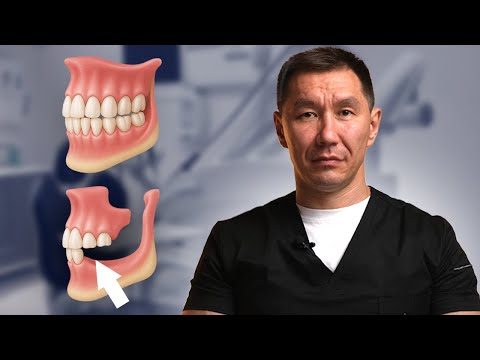 Lost a Chewing Tooth? DO THIS to Save Your Other Teeth