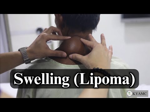 Examination of a Swelling ( Lipoma ) | Standardized Clinical Examination Videos | KYAMC