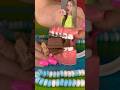 JUNKFOOD YOU CAN EAT WITHOUT BREAKING BRACES OFF 👀 ORTHODONTIST REACTS TO UNHEALTHY SNACKS 🦷