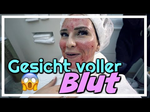 MARENS GESICHT IST VOLLER BLUT 😱 | 28.03.2018 | Daily Maren & Tobi