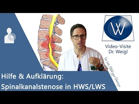 Spinalkanalstenose: Rückenschmerzen durch Spinalstenose in HWS/ LWS ⚡ Symptome, Gefahren & Therapie