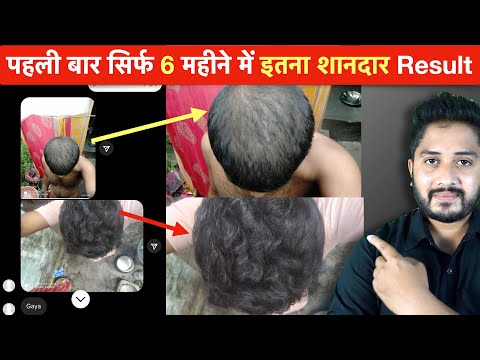 balayam-hair-growth Mp4 3GP Video & Mp3 Download unlimited Videos Download balayam-hair-growth Mp4 3GP Video & Mp3 Download unlimited Videos Download