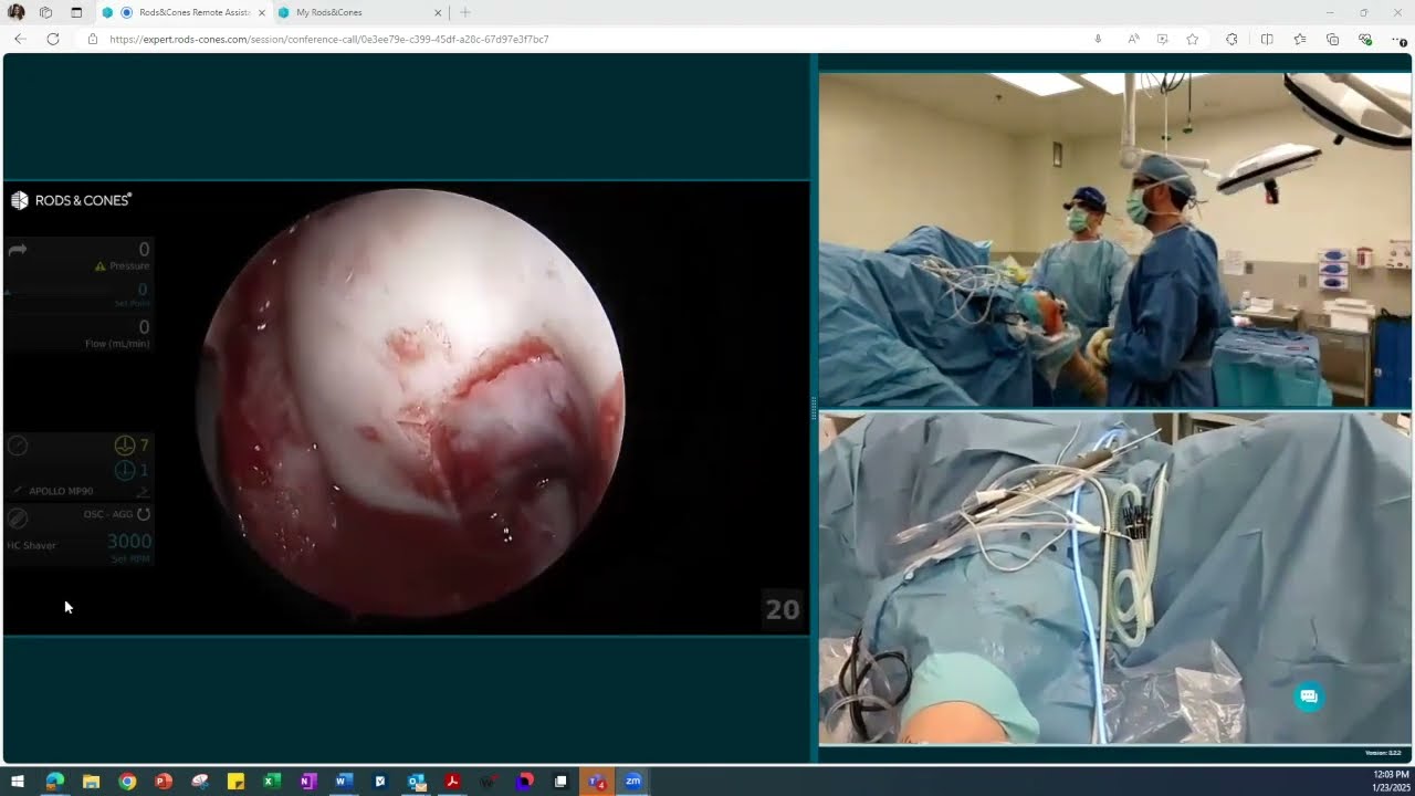 Live MACI Arthro: Rods & Cones System