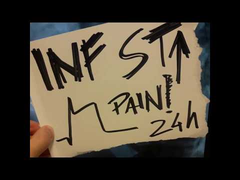 inferior STEMI - dual lumen micro