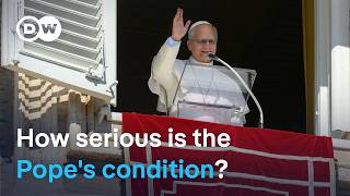 Pope Leo XIV faces surgery after lung diagnosis | DW News