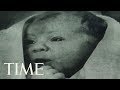 What It Was Like To Grow Up As The World's First 'Test-Tube Baby' | TIME