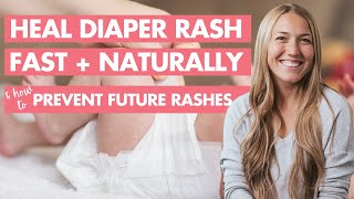 FAST + NATURAL Diaper Rash Treatment Every Parent Should Know