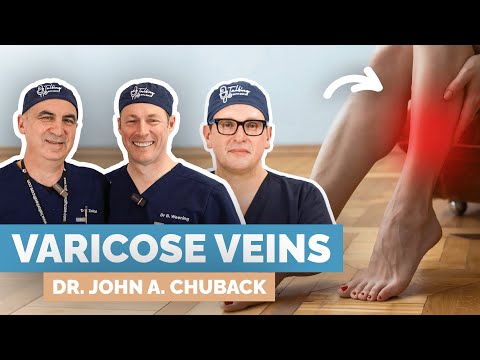 Ultimate Treatment Guide For Varicose Veins. Vascular Surgeon Explains
