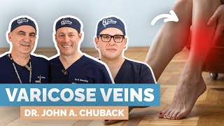 Varicose Vein Treatment Options: Vascular Surgeon Explains