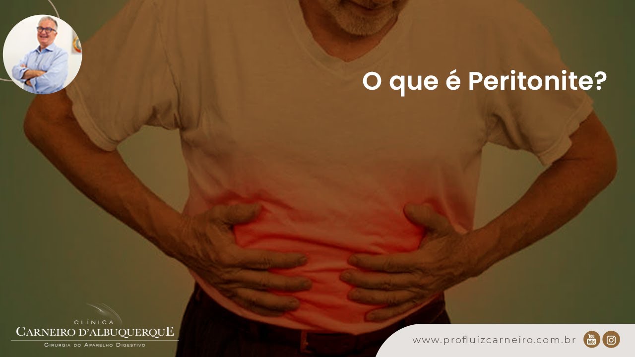 O que é Peritonite? | Prof. Dr. Luiz Carneiro CRM 22761