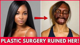 14 Black Hollywood Stars Whose Plastic Surgery Changed Everything | Then and Now 2026