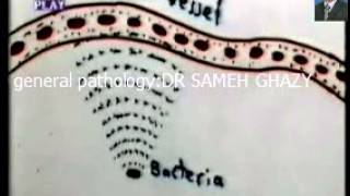 general pathology1 : inflammation 1: DR/SAMEH GHAZY