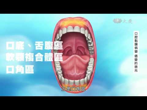 舌頭長痣看哪一科