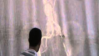 Surgical Radiology - 13 - Angiography 3