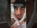 My Brother Got His Wisdom Teeth Out Foryou Wisdomteeth Brother