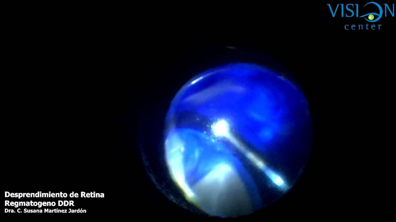 C. Susana Martinez Jardon-22