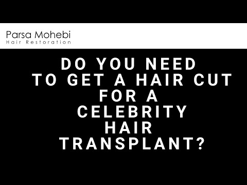 Do you need to cut your hair for a Celebrity Hair Transplant?