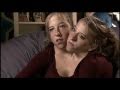 Abigail & Brittany Hensel - The Twins Who Share a Body