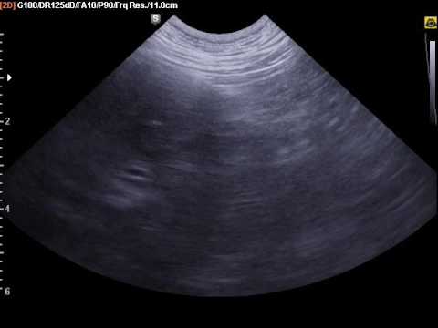 FNA watroby  , biopsja watroby u psa