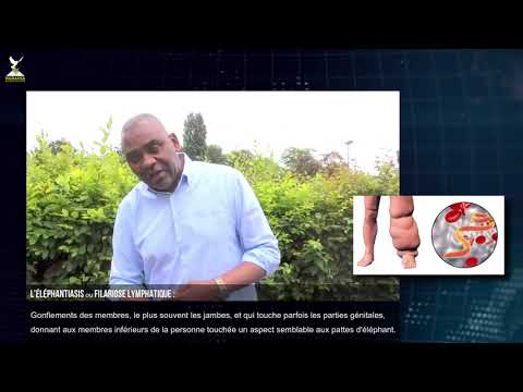 Watch Hadassa Care video