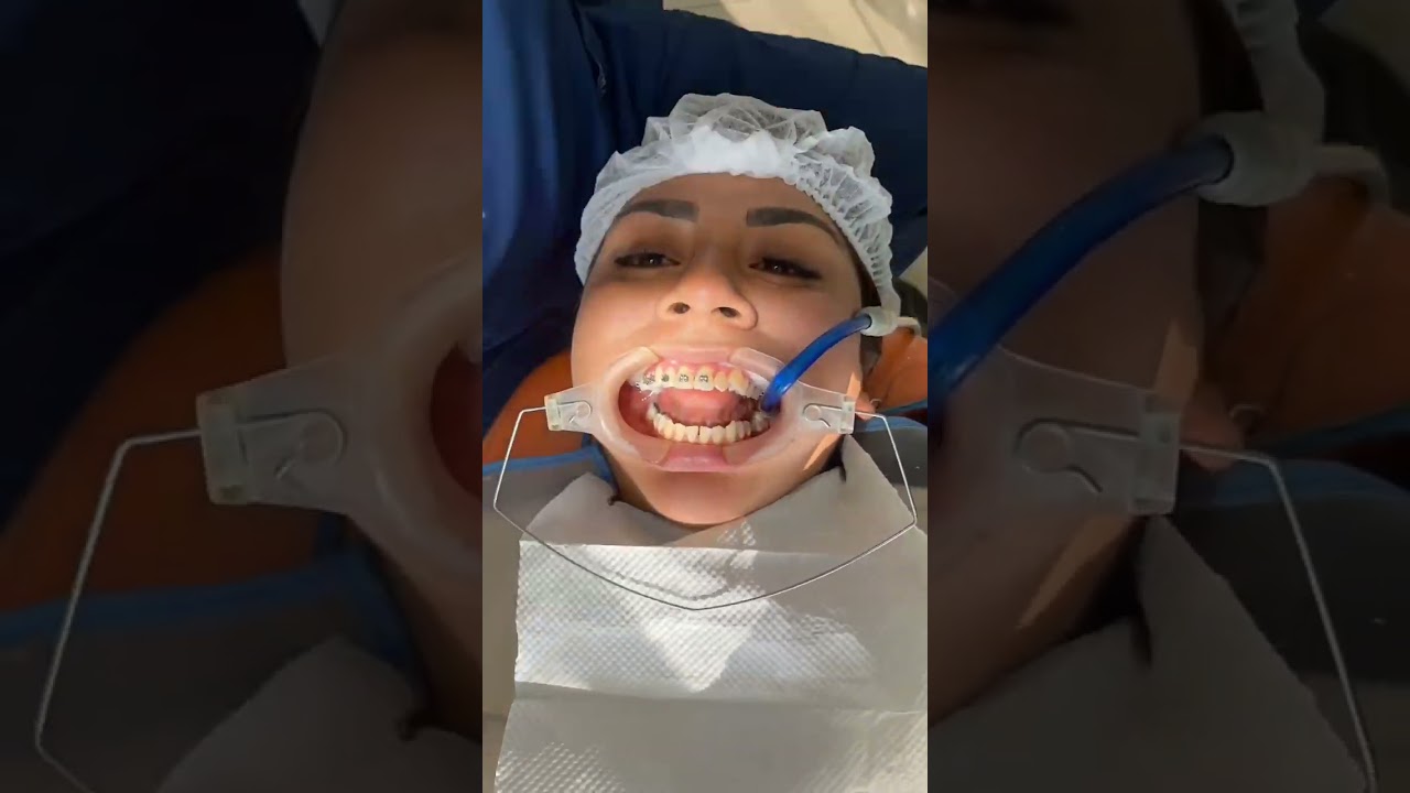 Dennis Ulloa Pinedo-10