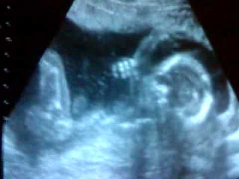 Ultraljudet i vecka 19