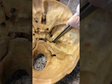 Agujeros del cráneo (Visión: Endocraneal)