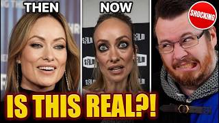 What are female celebrities doing to themselves?