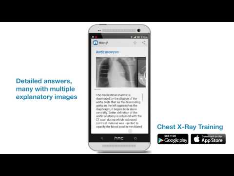Chest X-Ray Training Video