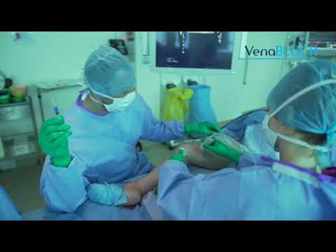 Varicose Vein Treatment