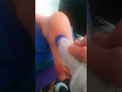 Fala uderzeniowa - Ostroga pietowa