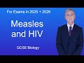 GCSE Biology Revision "Measles and HIV"