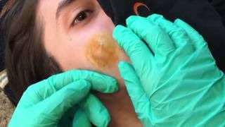 The Exorcism of Aaron