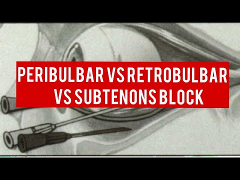 OCULAR  ANAESTHESIA || peribulbar block, retrobulbar block and subtenons block