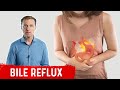 What is Bile Reflux?