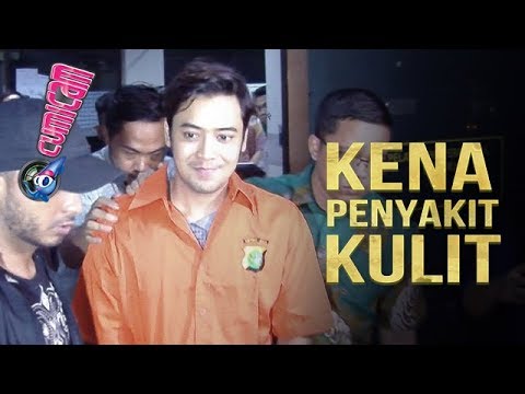 Berkulit Sensitif, Kriss Hatta Gatal-gatal di Tahanan - Cumicam 02 Agustus 2019