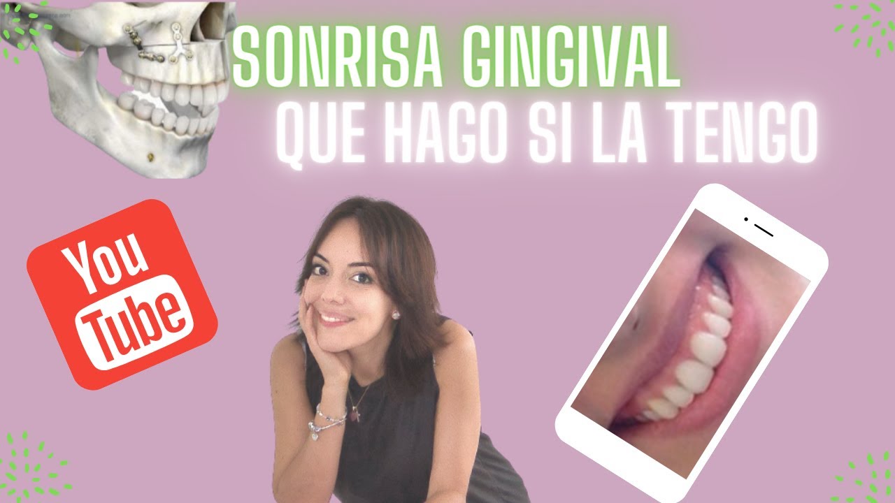 MUESTRAS MUCHA ENCÍA AL SONREÍR TE DIGO CÓMO MEJORAR