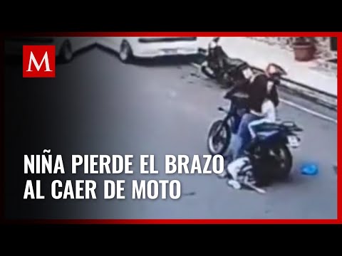 Menor sufre grave accidente en motocicleta en Ecuador: pierde su brazo