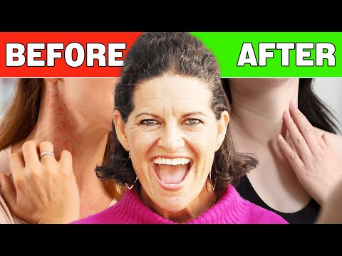 When I Quit Sugar, This Is How My Body Changed! | Dr. Mindy Pelz