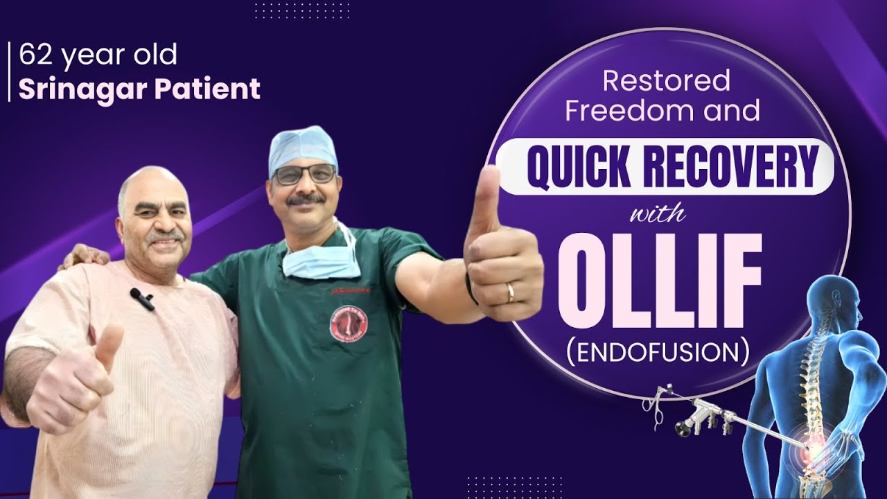 62 year old Srinagar Patient | Restored Freedom and Quick Recovery with OLLIF (Endofusion)