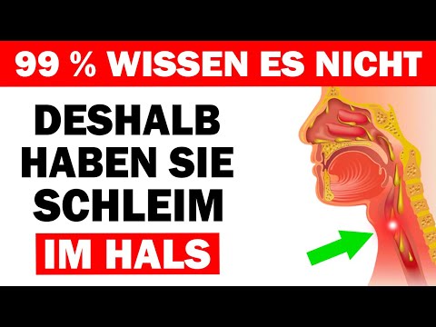 Ständiger Schleim im Hals? Diese Ursachen kennen die meisten nicht – so werden Sie ihn los!
