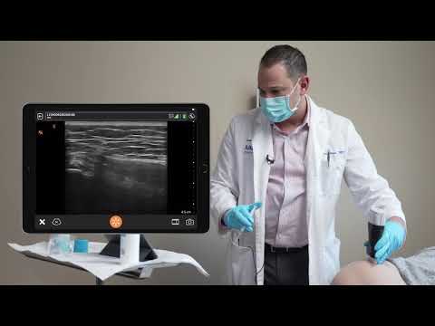 Gluteal Tendon Injections: Ultrasound Scanning Technique