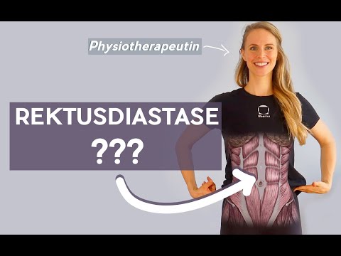 Was ist eine Rektusdiastase? + Selbsttest (Bauchmuskeltrennung)