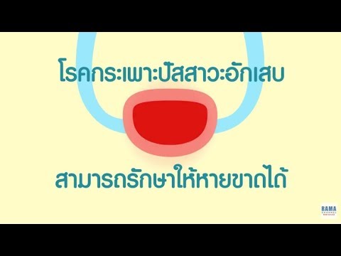 Danabol และความแข็งแรง Exciter สำหรับผู้หญิง Gomel