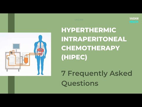 HIPEC- 7 Frequently Asked Questions