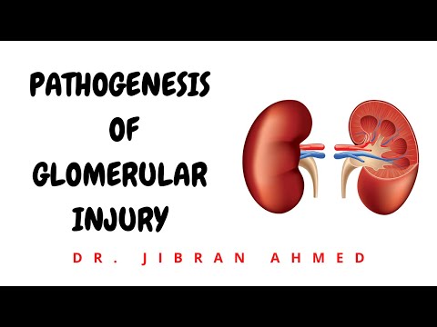 NORMAL KIDNEY STRUCTURE II GLOMERULUS II FILTRATION BARRIER II SLIT DIAPHRAGM II ROBBINS 10TH E II