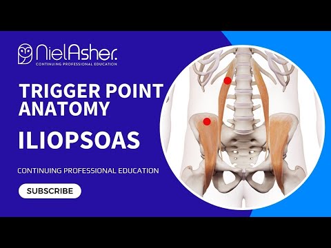 Exploring the Iliopsoas: Understanding Trigger Point Locations for Better Muscle Health