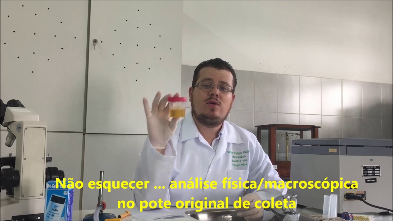 Aula prática de urinálise - Professor Willian (Uniandrade)